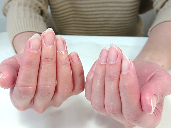 手肌をキレイに保つネイルケア